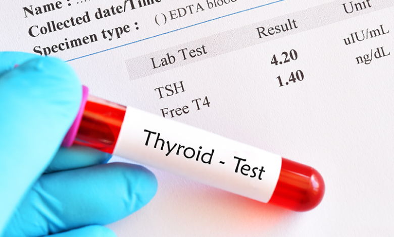 thyroid test in greater noida