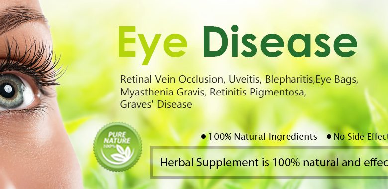 Herbal Remedies for Eye Diseases